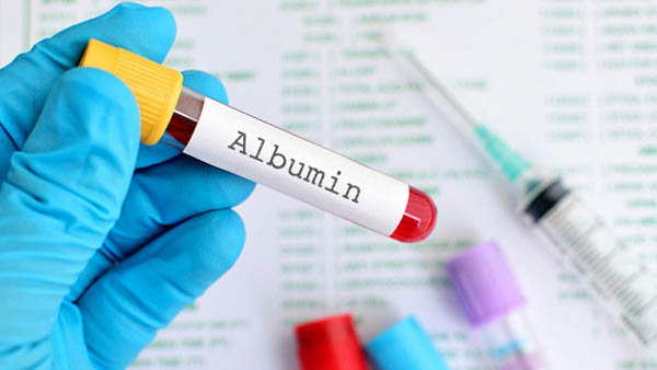 Albumin huyết thanh