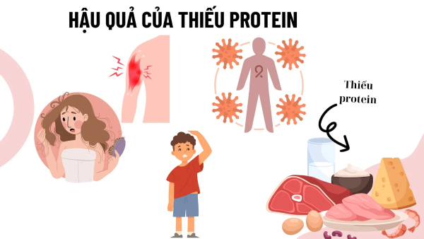 Biểu hiện, hậu quả và cách bổ sung kịp thời khi thiếu Protein